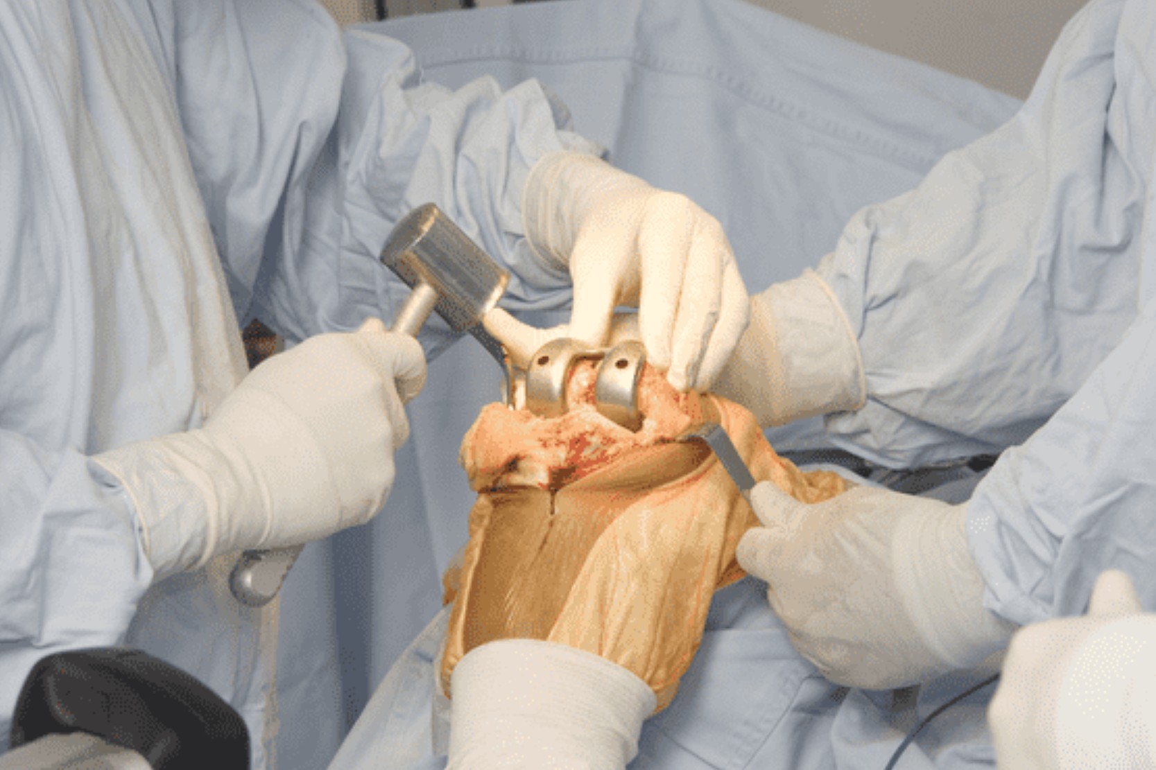 Who are orthopaedic surgeons and what do they do?